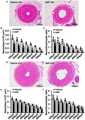 Andrographolide Promotes Interaction Between Endothelin-Dependent EDNRA/EDNRB and Myocardin-SRF to Regulate Pathological Vascular Remodeling